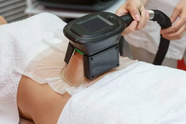 Image of person having fat freezing treatment to help weight gain Broomhill