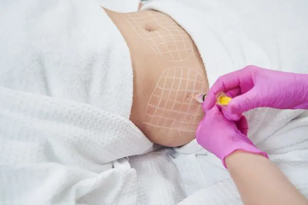 image of fat dissolving injections on love handles to help combat weight gain Broomhill
