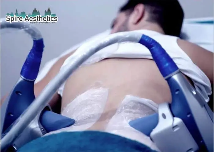 Man having fat freezing treatment done on love handles before a competitions Broomhill to create a sculpted look.